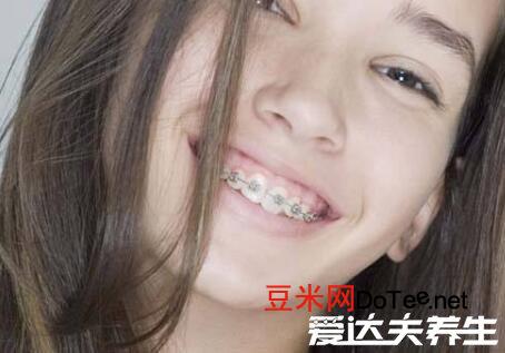 带牙套的年龄，12到18岁最适合带牙套(三大注意事项)