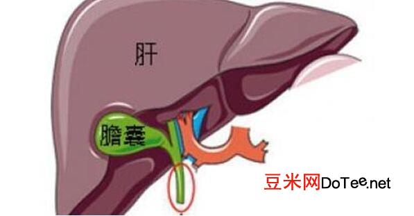 胆囊疼的真人位置图，右上腹向右肩背放射痛注意和肝痛区分