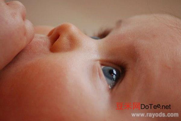 婴儿眼睛有点对眼怎么矫正，婴儿对眼多久恢复正常？婴儿对眼最佳治疗时间