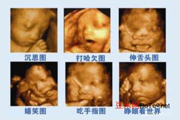 胎儿五个月彩超图 怀孕五个月胎儿真实图片