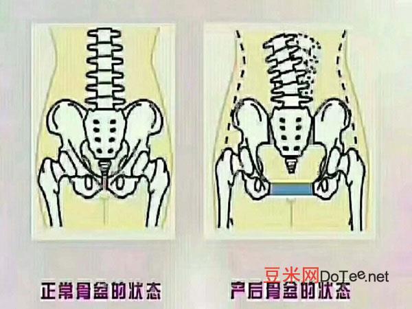 产前产后骨盆的对比图