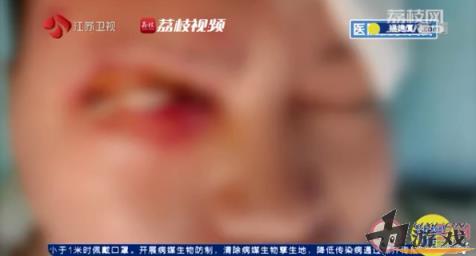 睡觉时充电器爆炸险失明是怎么回事 睡觉时充电安全吗