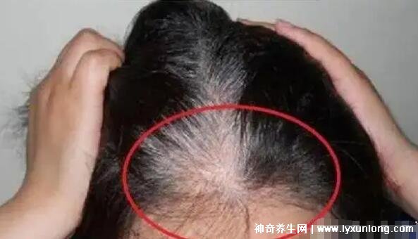 三个部位长白发最危险的图片？三个部位长白发最危险的图片是什么