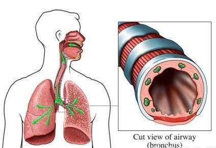 气管和食道位置三维图？气管和食道位置三维图痰从哪个部位咳出来