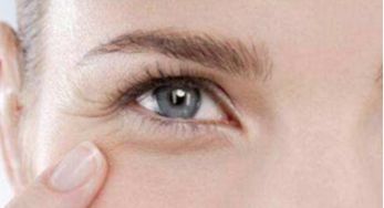 去眼角皱纹最好的方法是什么？淡化眼部皱纹的五个方法图片