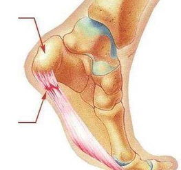 脚底疼痛是什么原因？足底疼的原因是什么原因