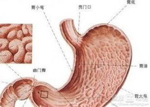 胃窦炎吃什么药？慢性胃窦炎该吃什么药能不能根治呢
