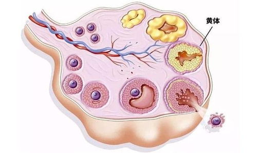 黄体破裂是什么原因造成的？左卵巢黄体破裂是什么原因导致的