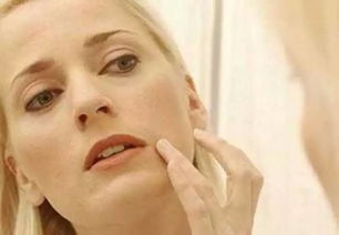 皮肤松弛有什么办法可以改善？怎么治疗皮肤松弛最有效