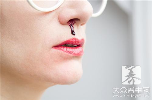 鼻子流鼻血什么原因导致的？鼻子流鼻血是哪些原因